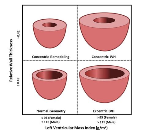 relative wall thickness calculator